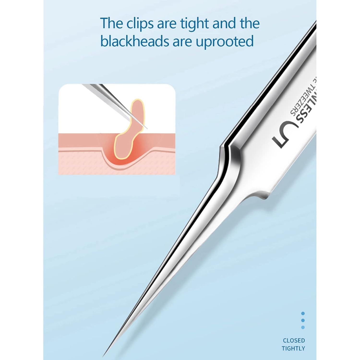 Acne Clips Cell Clip Tweezers Pimple Squeeze Tool Acne Needle Blackhead Acne Remover Stainless Steel for Beauty Salon Household