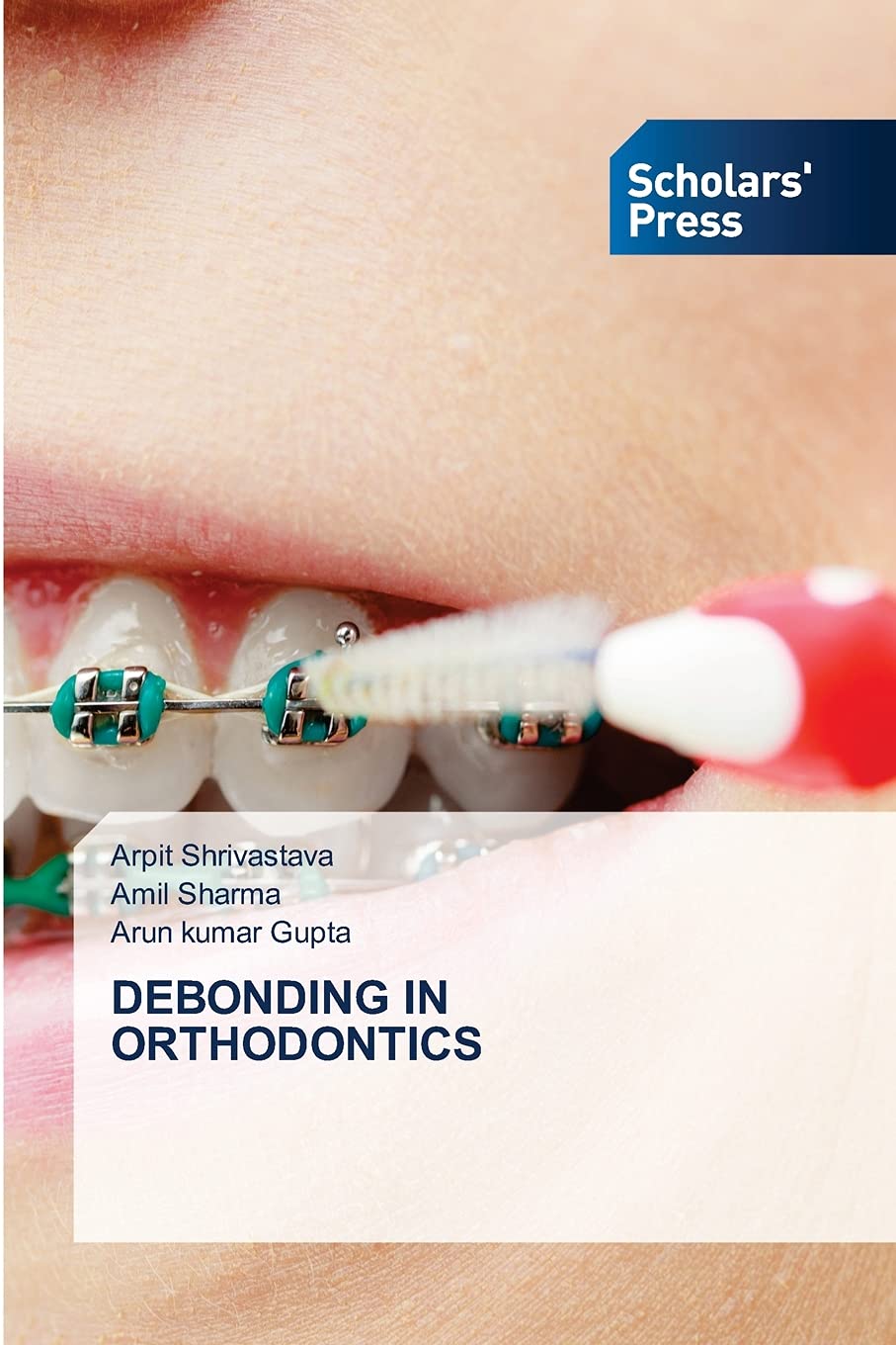 DEBONDING IN ORTHODONTICS