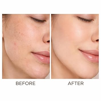 Lanthome Advanced PDRN Rejuvenating Cream - Cell-level Repair, Triple Hydration, Barrier Strengthening, Lightweight, with Sodium DNA & Niacinamide for Elastic Radiant Skin 20mL