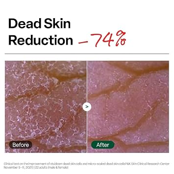 Dr. G Brightening Peeling Gel - Korean Skincare for Glowy Skin - Aqua Gommage Facial Exfoliator - Hyaluronic Acid, Ceramides, Vitamin C - Smooth Skin Texture, Low Irritation - Bulk Items - 4.23 fl oz
