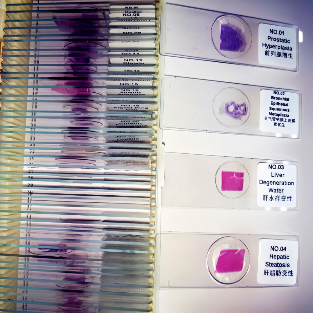 50Pcs/Set Human Pathology Slides Set Pathology Histology Prepared Microscope Slides