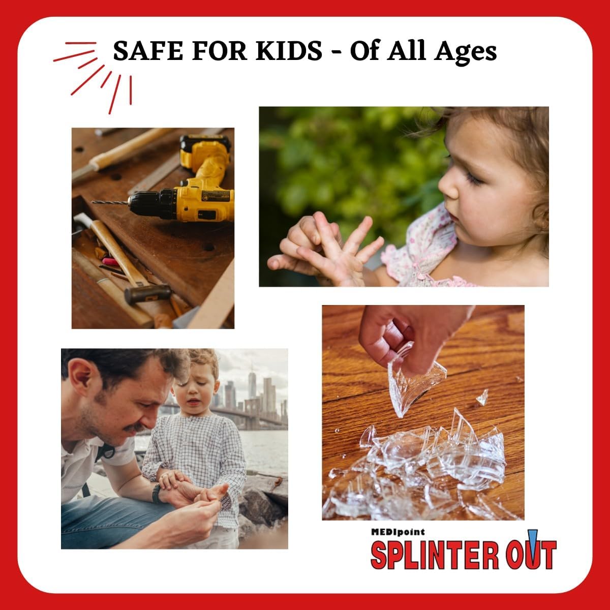 Splinter Out Splitterentferner, 20 Stück, 1 Stück