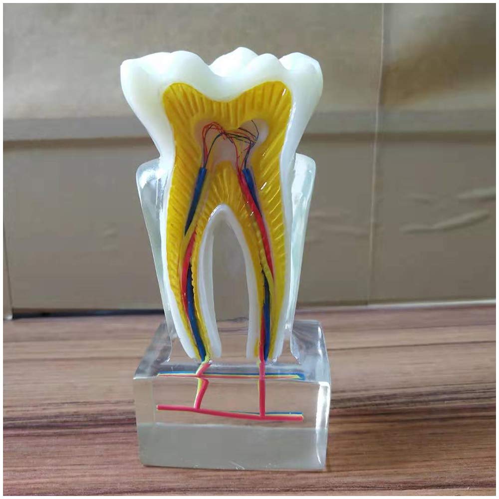 Sjdopulse Dental Teeth Model - 6X Crystal Transparent Teeth Demonstration Teaching Model - Doctor-Patient Communication Tooth Model - For Teach Study
