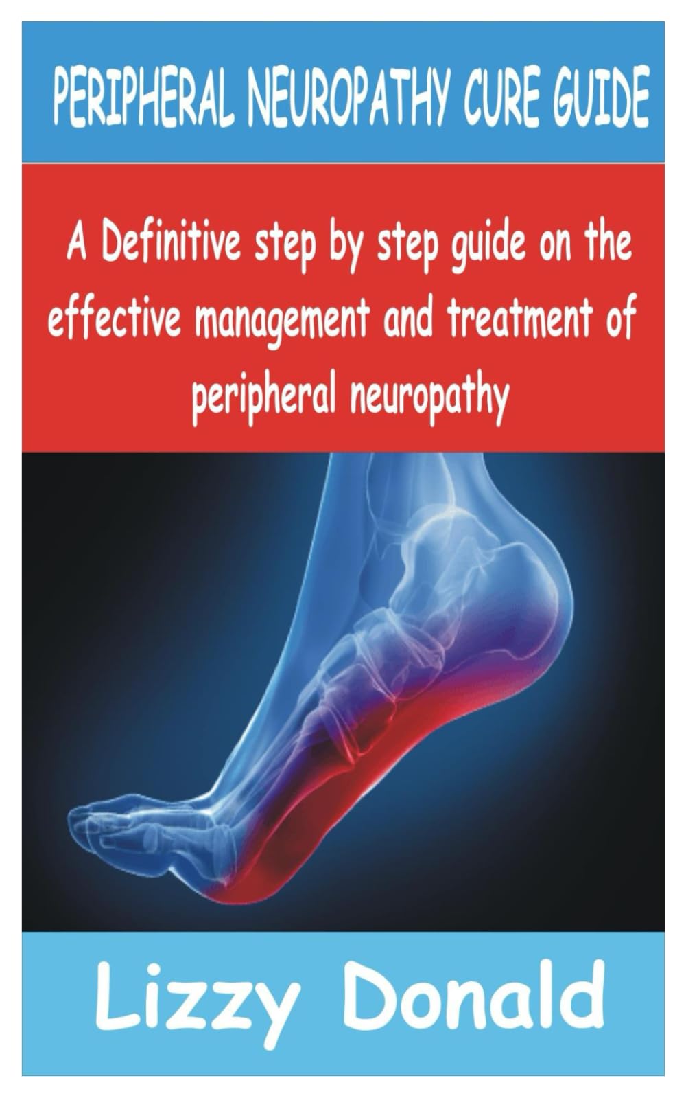 PERIPHERAL NEUROPATHY CURE GUIDE: A Definitive Step by Step guide on the Effective management and treatment of peripheral neuropathy