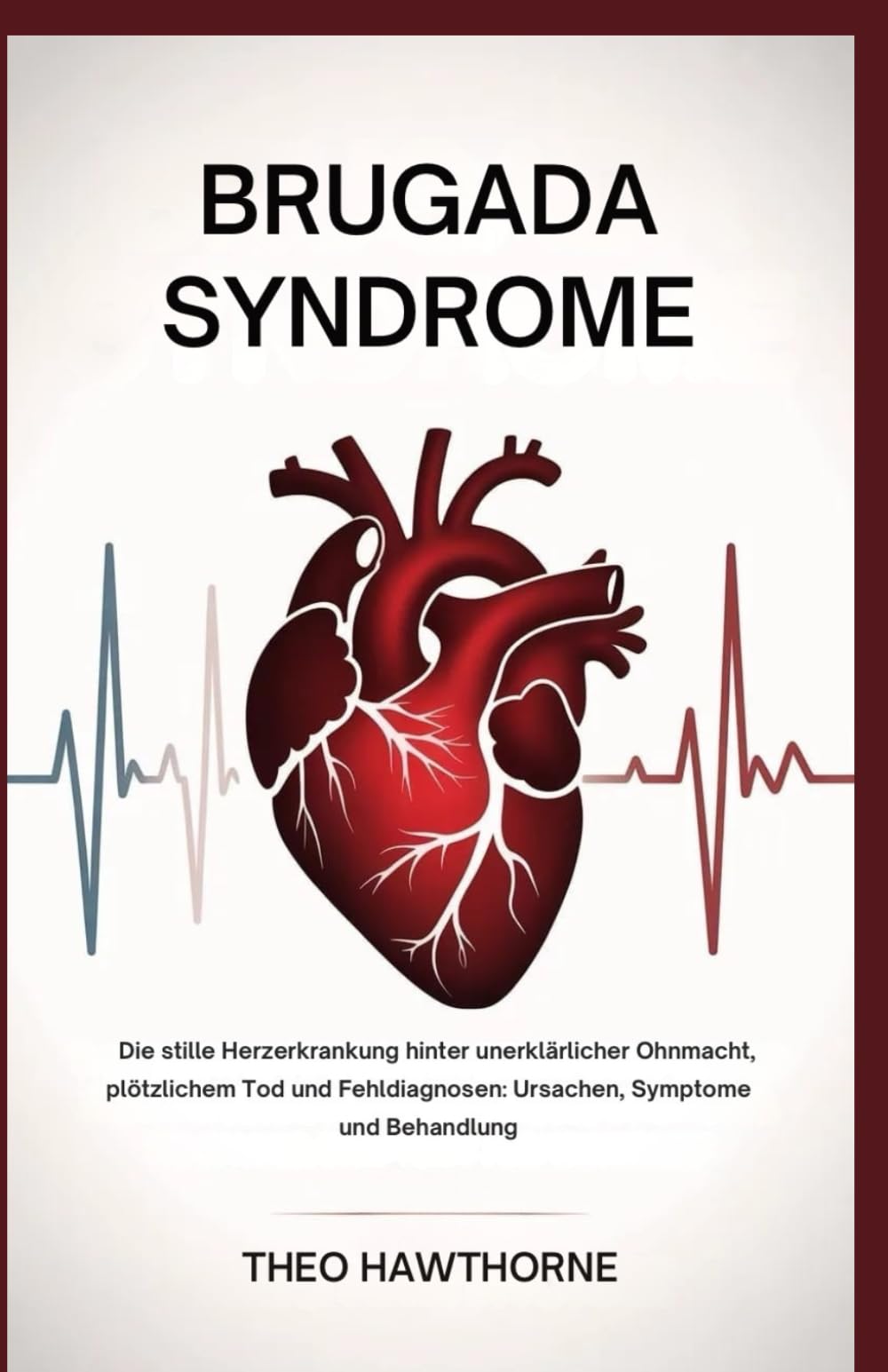 Brugada Syndrome: Die stille Herzerkrankung hinter unerklärlicher Ohnmacht, plötzlichem Tod und Fehldiagnosen: Ursachen, Symptome und Behandlung