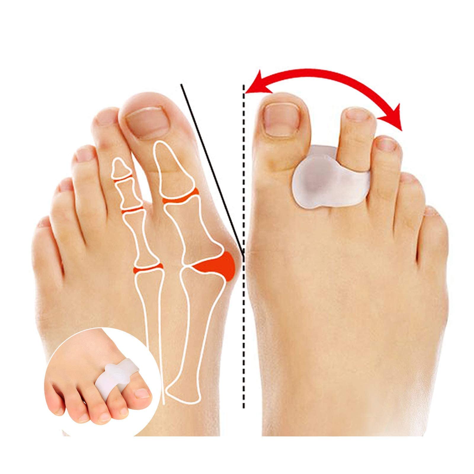 Toe separators for Women,Toe spacers toe separator Bunion Corrector for