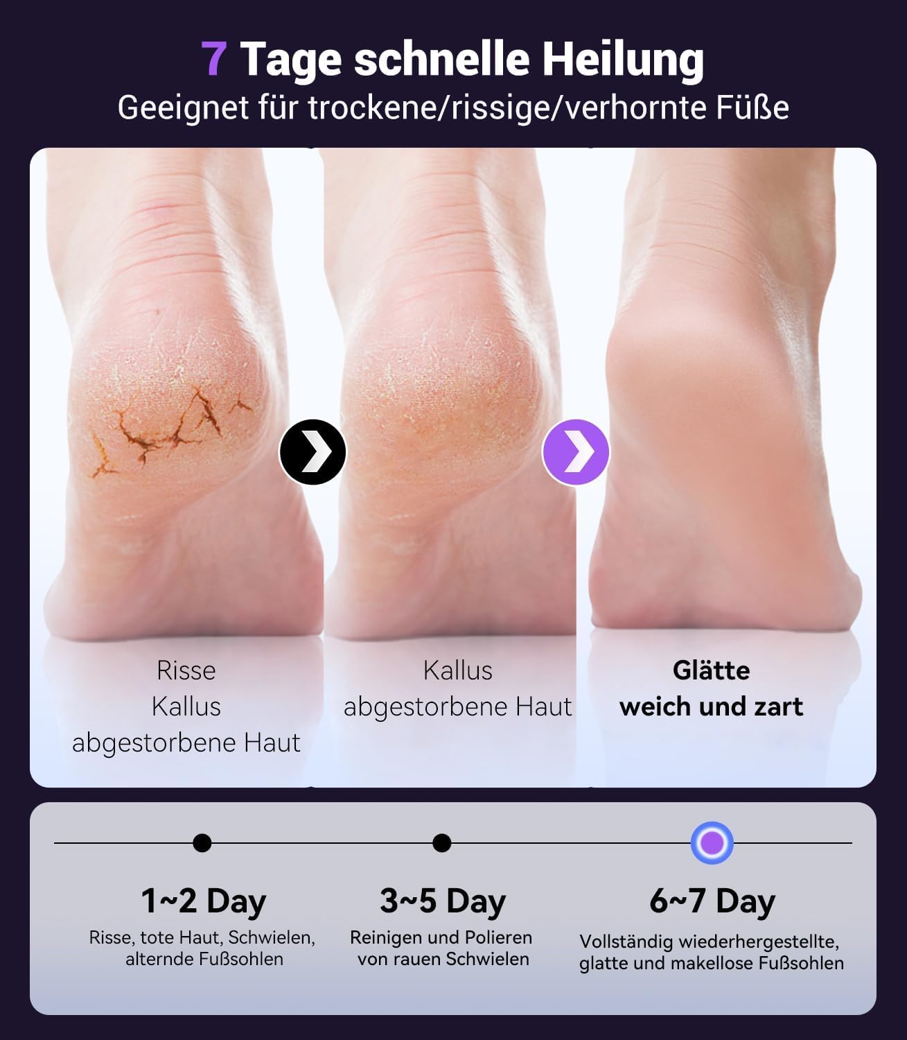 Hornhautentferner elektrisch【Peeling NO.1 – 0 Handschwielen,0 Harte Haut,0 Risse】Hornhaut entfernen Fuß【99.92% Entfernung in 3 Min – 9 Stufen】Wiederaufladbar mit Type-C (Violett)