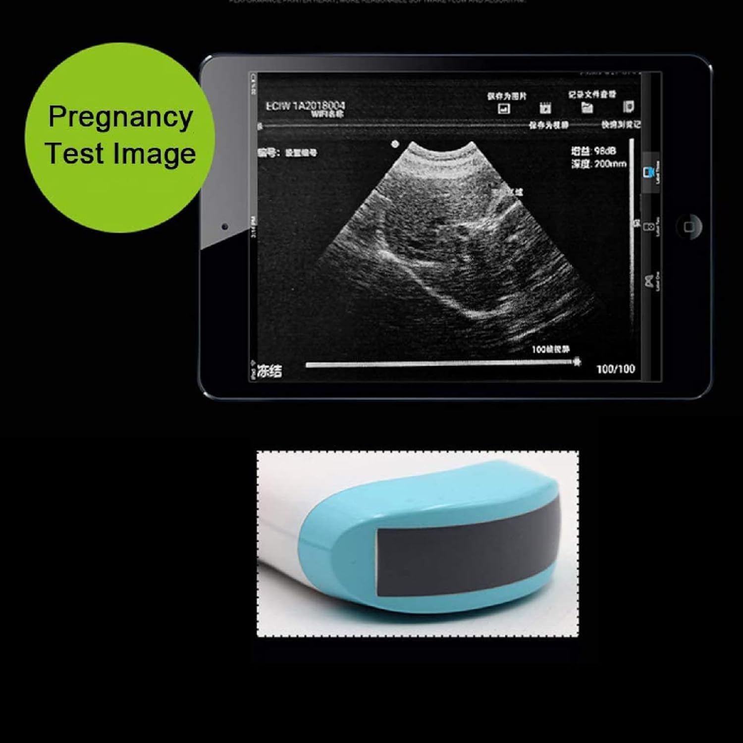 Scanner portatile wireless ad ultrasuoni per diagnosi veterinaria di gravidanza, sonda 3,5 MHz, batteria 4500 mAh, ricarica USB per maiali e pecore