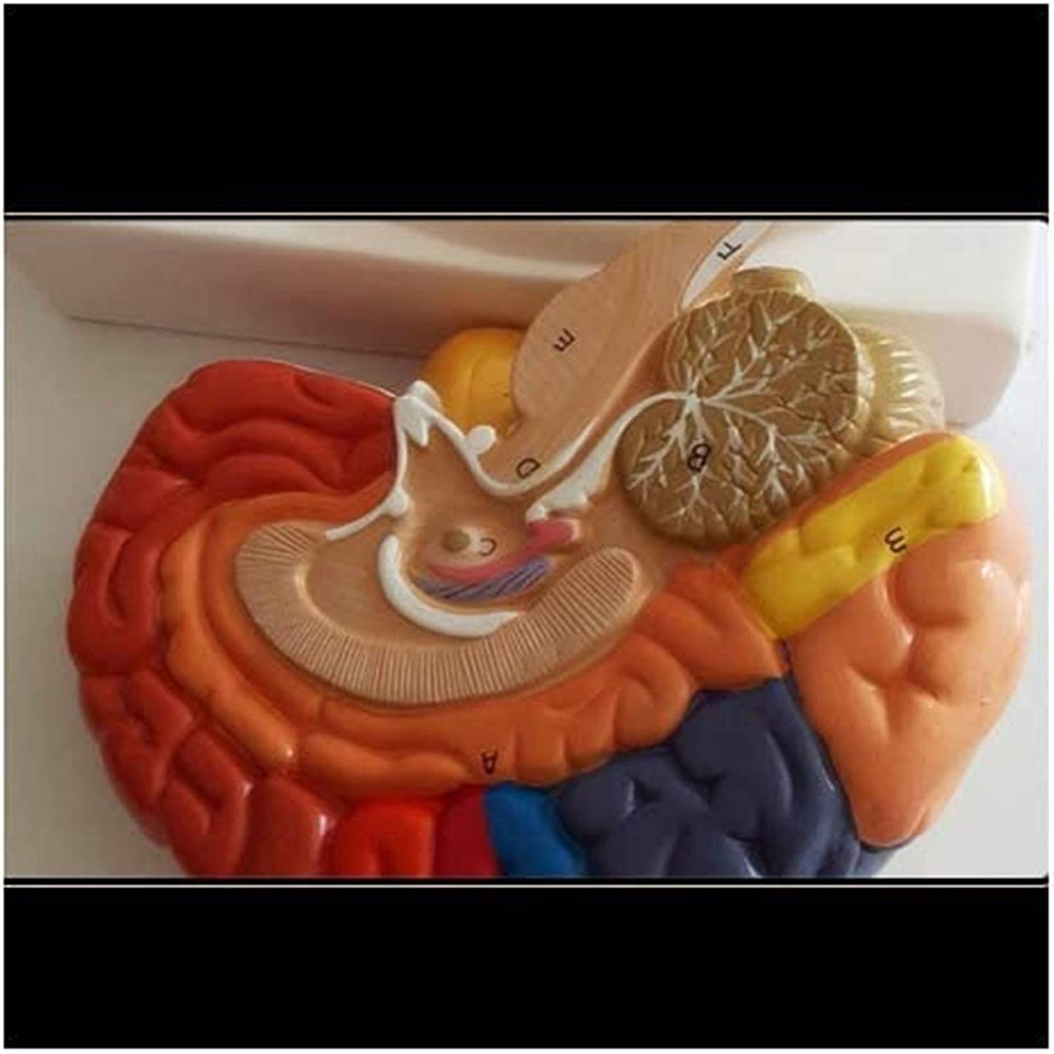 Model anatomiczny, model edukacyjny ludzkiej nerki model - medyczny anatomiczny model nerek model anatomii narządów człowieka - kompatybilny z medyczną pomocą edukacyjną, materiałami laboratoryjnymi,