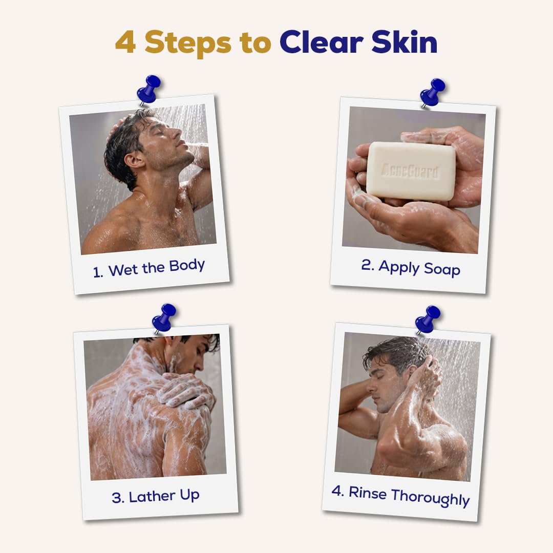 Pil Acneguard Soap | Clears Acne, Pimples, Clogged Pores | For Face And Body | Perfect Blend Of Natural Ingredients | Deeply Cleanses | Gentle | Refreshing (75gm Each, Pack of 3) 3