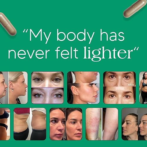 Miniatura 4 de Megacephalus Sculptique - Cápsulas de drenaje linfático, nueva fórmula de máxima potencia con extracto de diente de león, extracto de cuchillas,