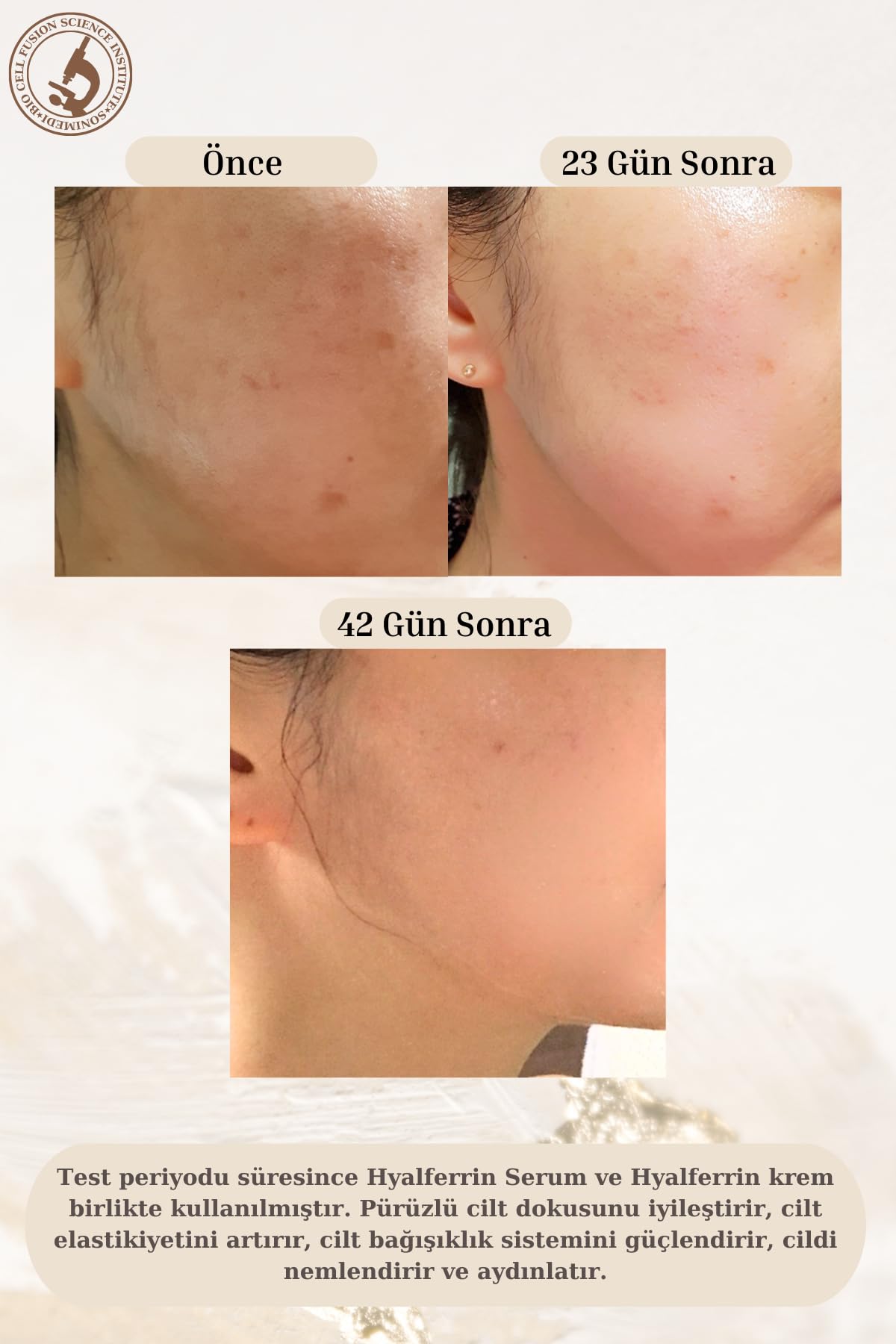 Hyalferrin Biogen Sinyal Kremi | 50 ml | Yüz Kremi | Cilt Bariyeri Oluştucu Etki | Dünyanın İLK cilt için optimize edilmiş Laktoferrini
