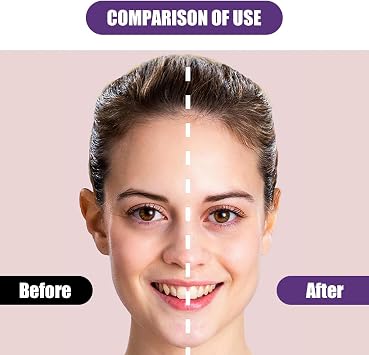 EELHOE 2 PCS Cosmetic Ear Corrector, Ear Stickers Correctors, Suitable for All Ages, Styling, Waterproof, Supports and Corrects Protruding Ears, Ears Appear Small (12 Stickers)