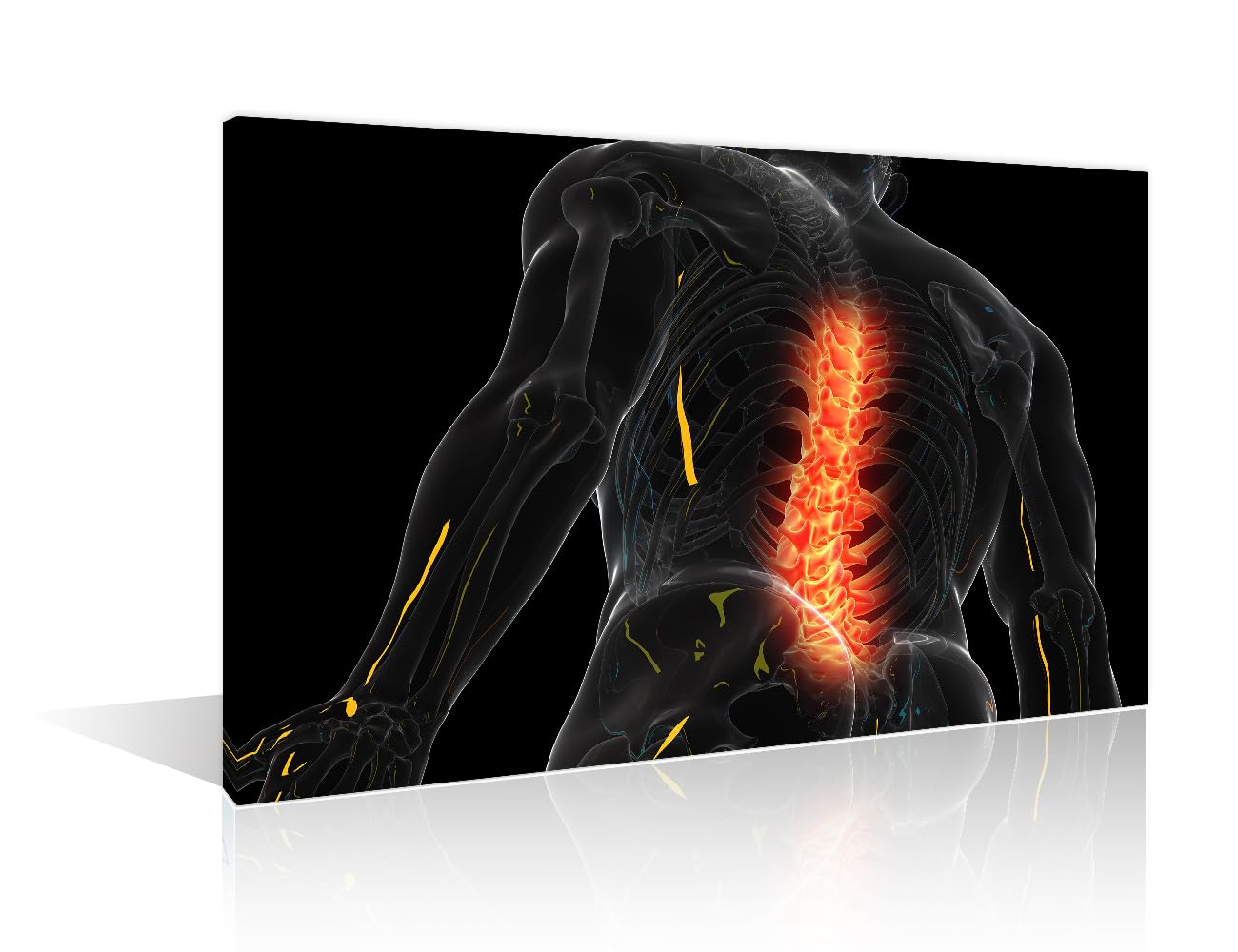 Contemporary Modern ArtworkCervica Spine Skeleton X Ray Medical Concept Pictures Artwork Wall Decor Posters and Prints 1 Panels Skeleton X-Ray 1D Pictures Art Prints Framed Ready to Hang (16"Wx24"H)