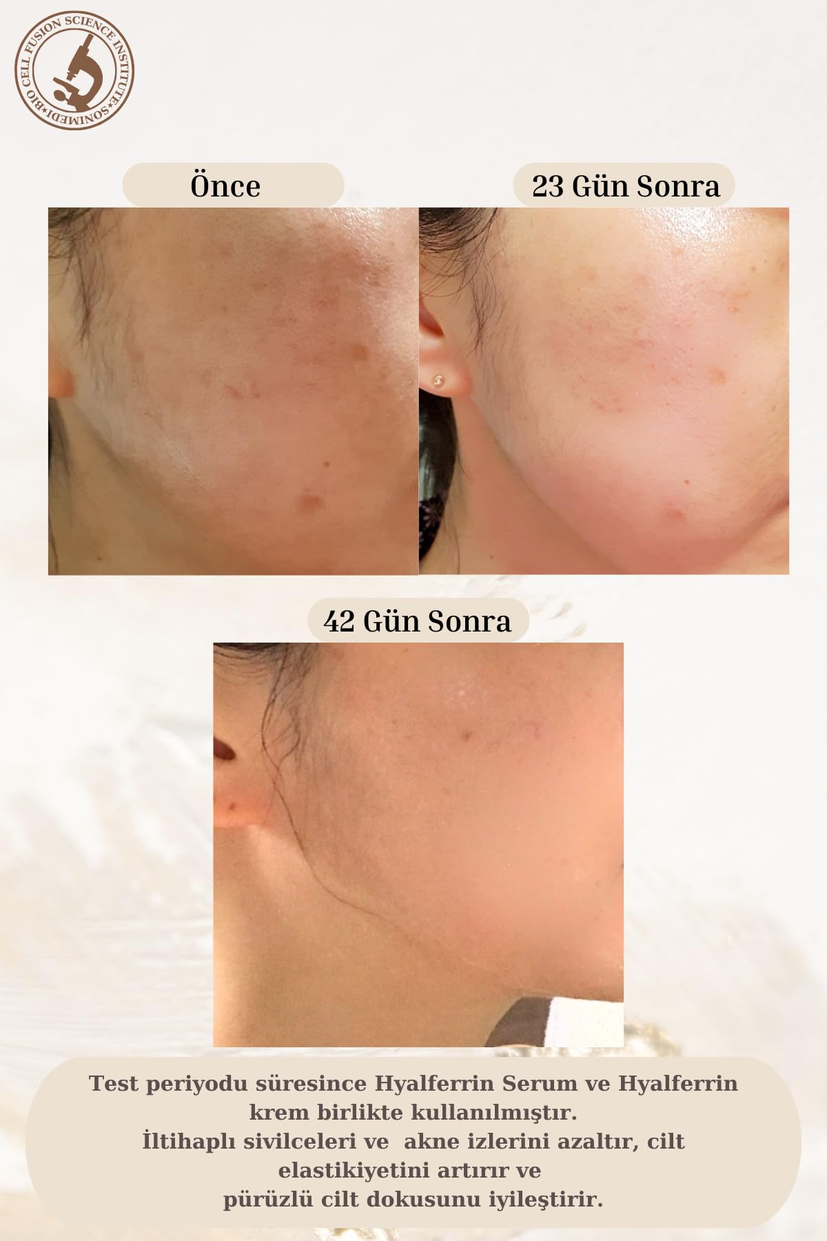 Hyalferrin Biogen Signal Serum, Cilt Sorunlarına Karşı Etkili, Bariyer Güçlendirici, Nemlendirici ve Yatıştırıcı Serum, Hassas ve Tüm Ciltler İçin, 40 ml - Ovaco