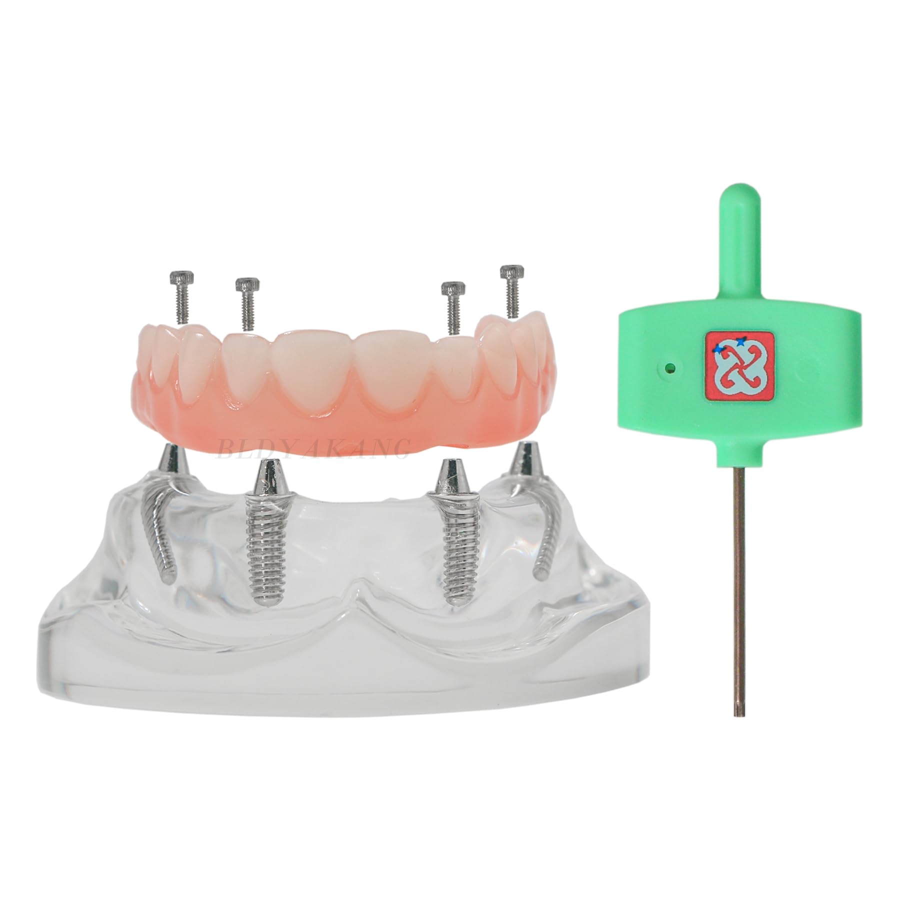 Dental Typodont Model Overdenture Implant Simulator, Upper Jaw, Detachable, 4 Screws Post Core Bridge, Comes with a Hex Driver Screwdriver