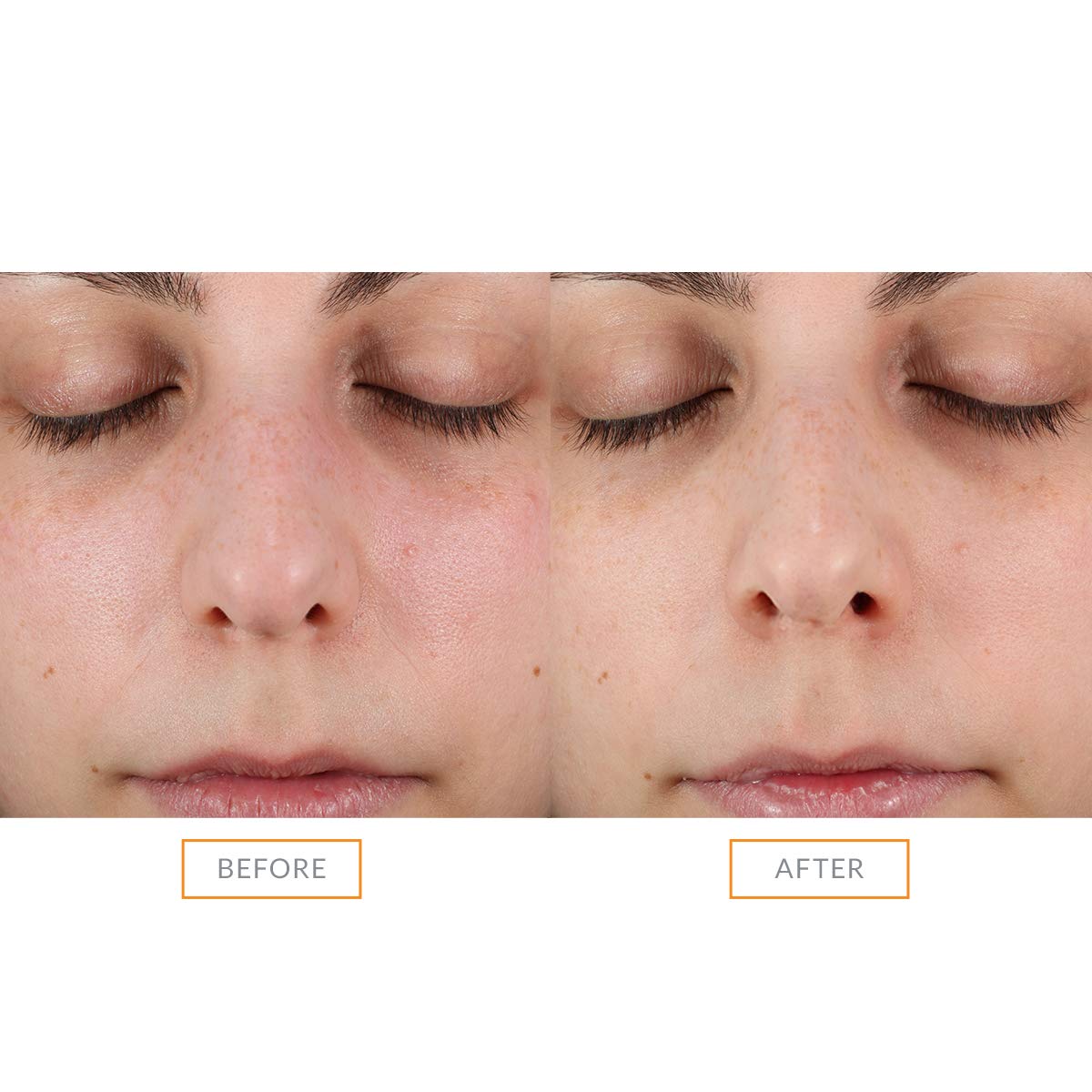 Clarisonic Sonic Face Exfoliator Cleansing Brush Head | Gentle Exfoliating Brush to Brighten Skin | Suitable for Sensitive Skin - Image 4