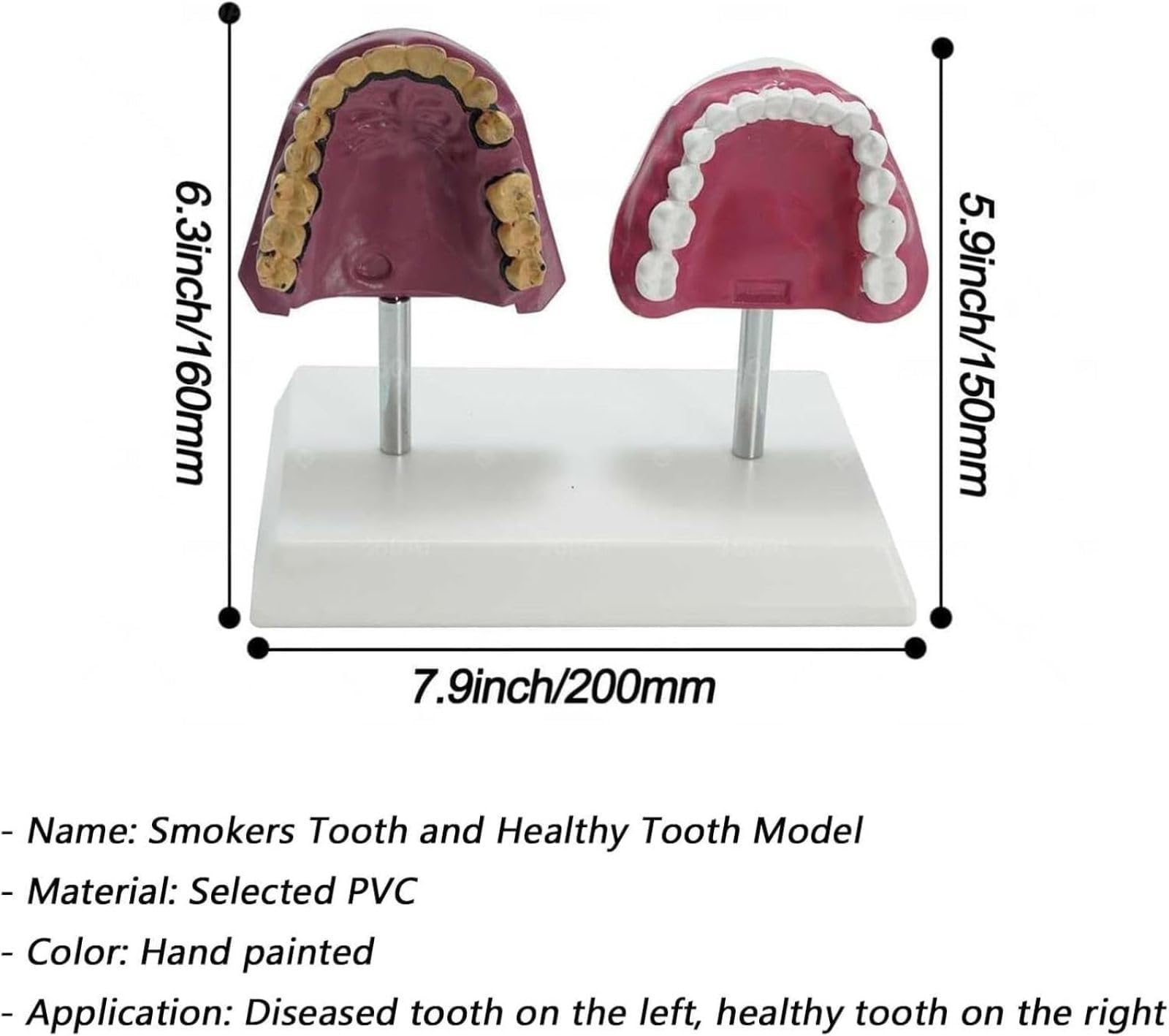 Modello Anatomico dei Denti del Orale Umano, Struttura Anatomica Accurata E Patologica, per Studenti di Odontoiatria