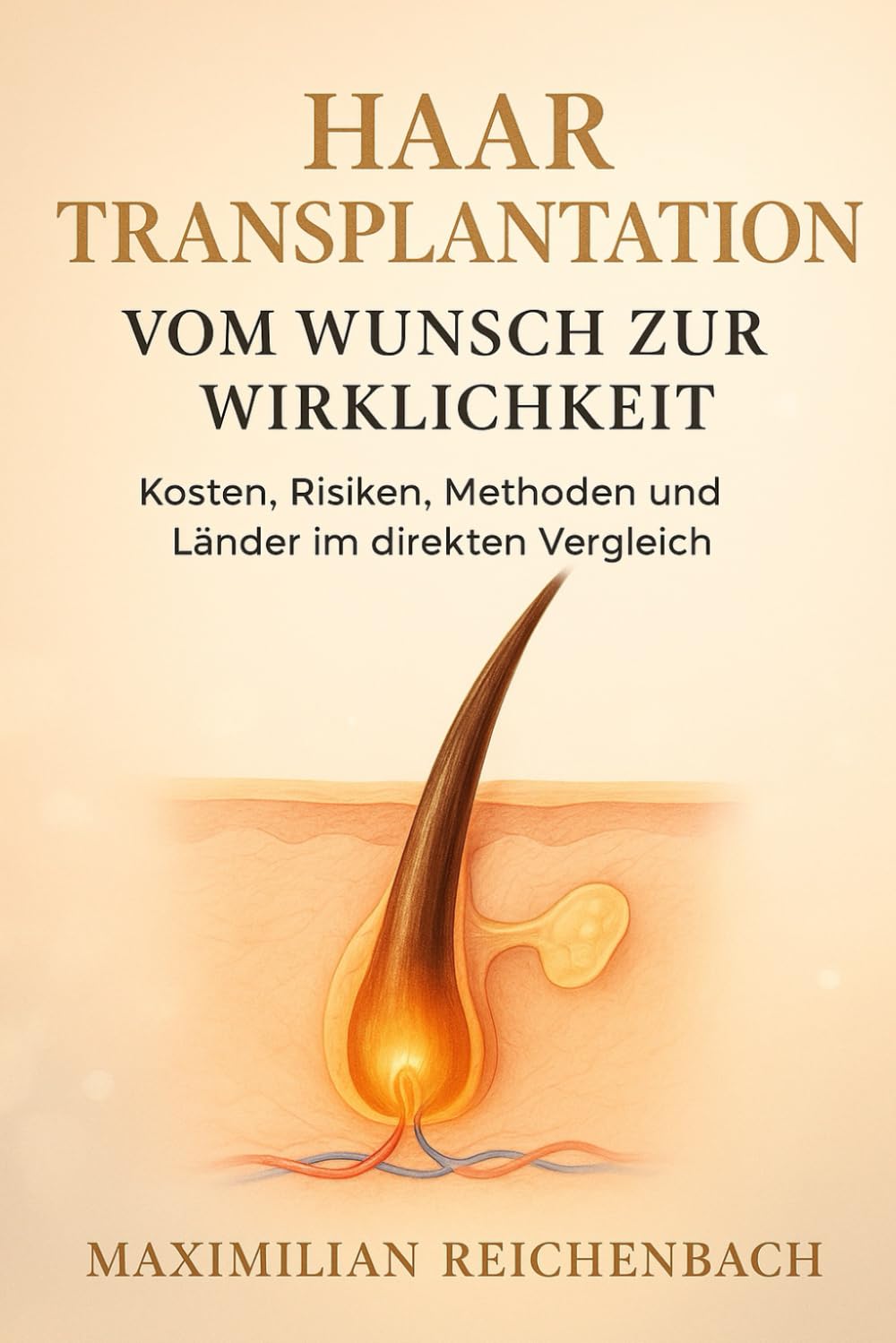 Haartransplantation: Vom Wunsch zur Wirklichkeit: Kosten, Risiken, Methoden und Länder im direkten Vergleich (Haarausfall)