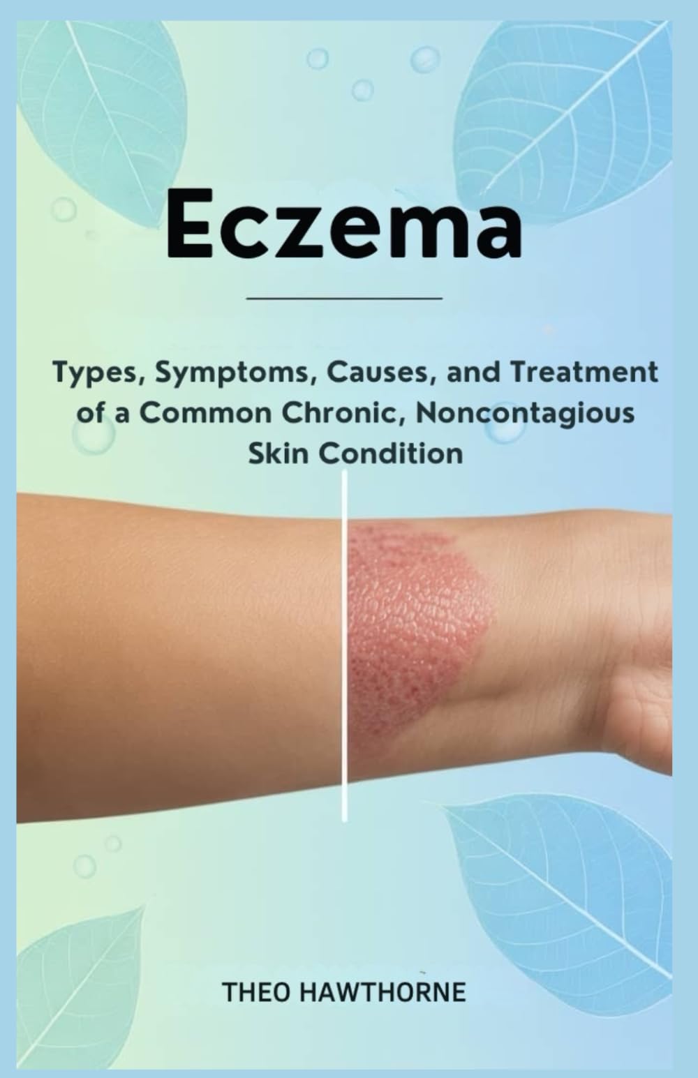 Eczema: Types, Symptoms, Causes, and Treatment of a Common Chronic, Noncontagious Skin Condition
