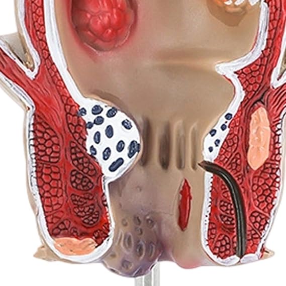 Human Pathologies Model Human Rectum Model Ornaments Human Anatomical Model Medicals Teaching Tool for Teaching
