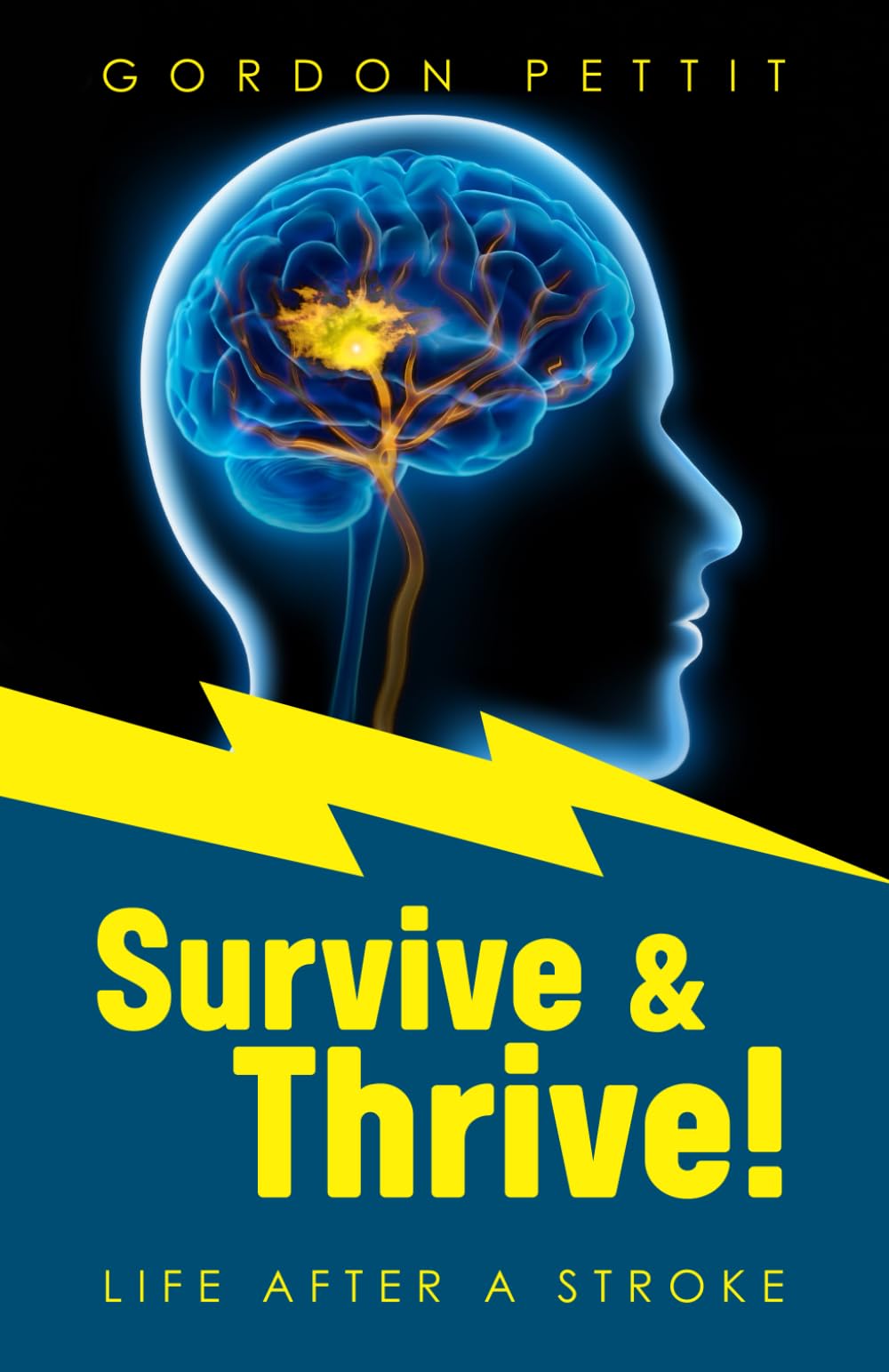 Survive & Thrive!: Life After A Stroke