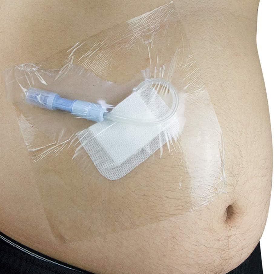 Biopsy Punch Stérile 2 mm STIEF-BP2 outil de carottage cutané dermatologique pack 10