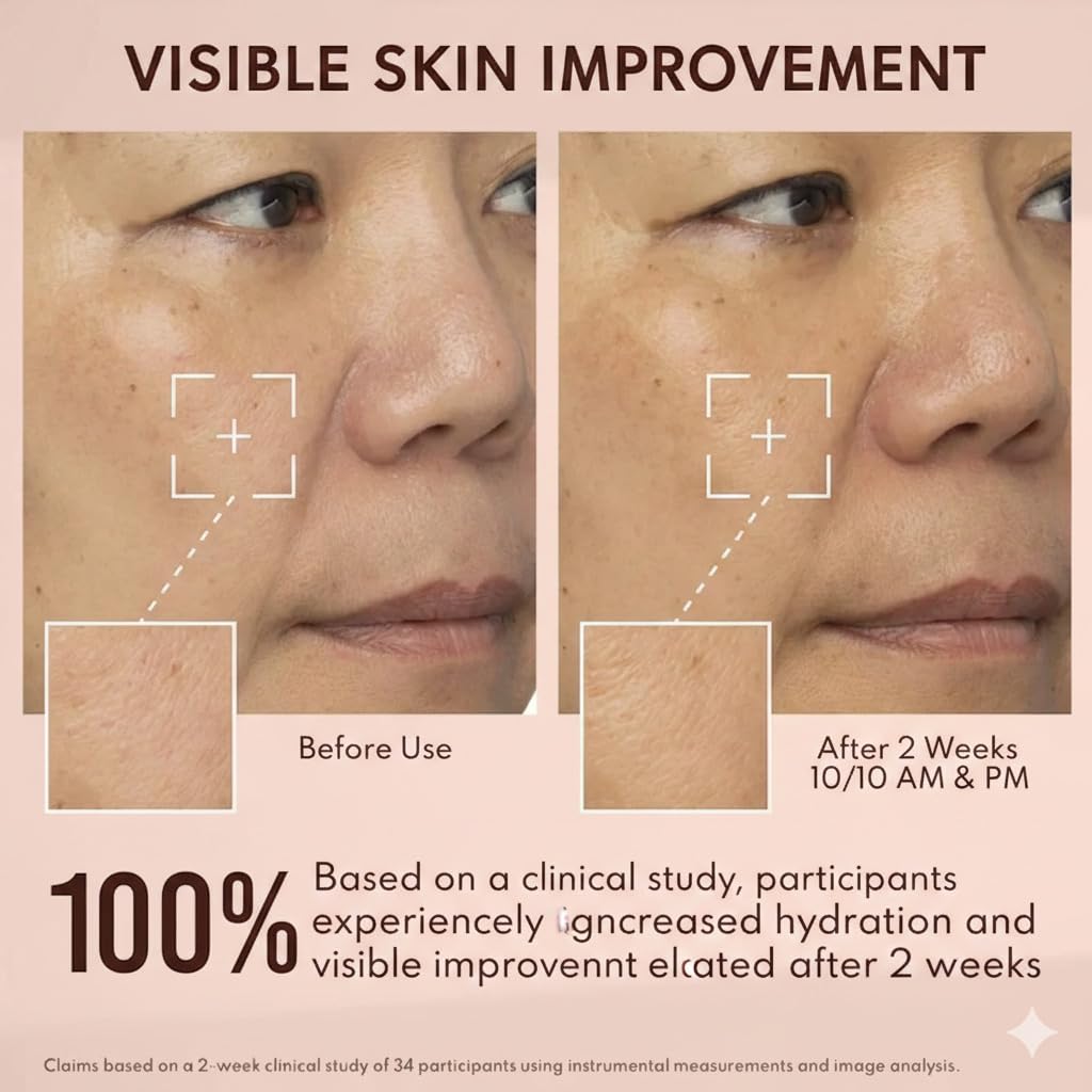 Yummy Skin 10/10 Barrier Boost Hyaluronic Acid + Ectoin Plumping Serum - Supercharged Hydrating Formula with 10 Molecular Weights of Hyaluronic Acid + Ectoin – 1.69 fl oz
