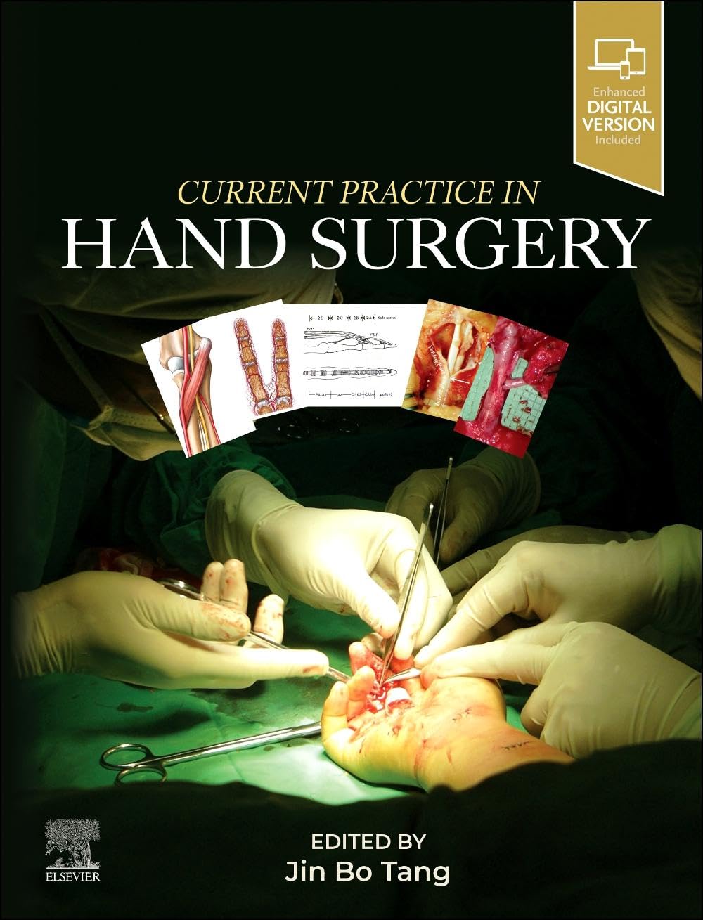 Current Practice in Hand Surgery: Amazon.co.uk: Tang MD, Jin Bo
