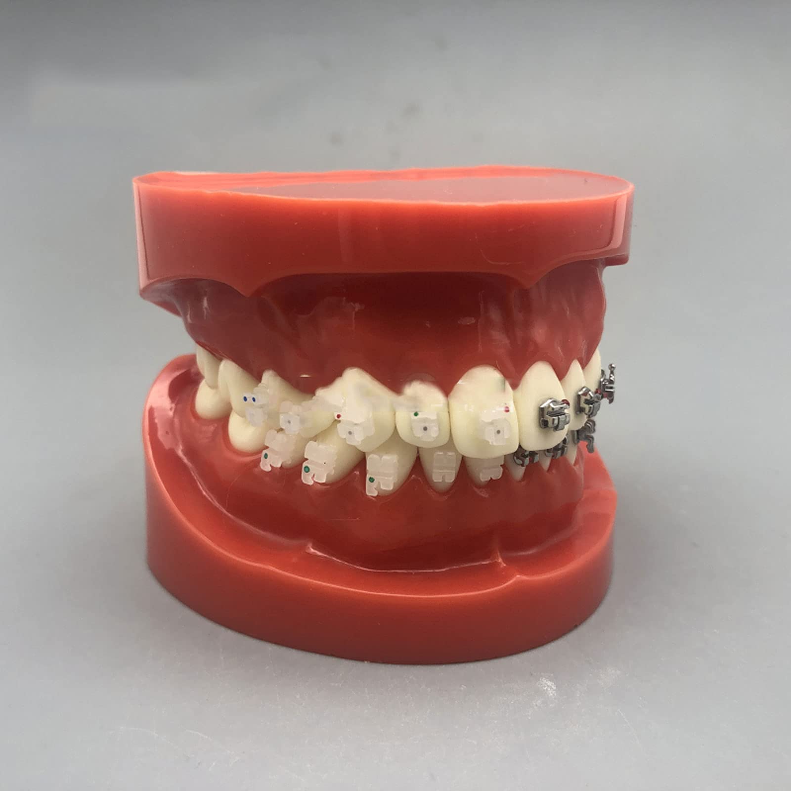 Modelo de Dientes de Implantes Dentales, Modelo de Dientes Dentales, Cuatro Modelos de Comparación de Soportes, Duraderos Adecuado para Intercambios de Demostración Entre Médicos y Pacientes.