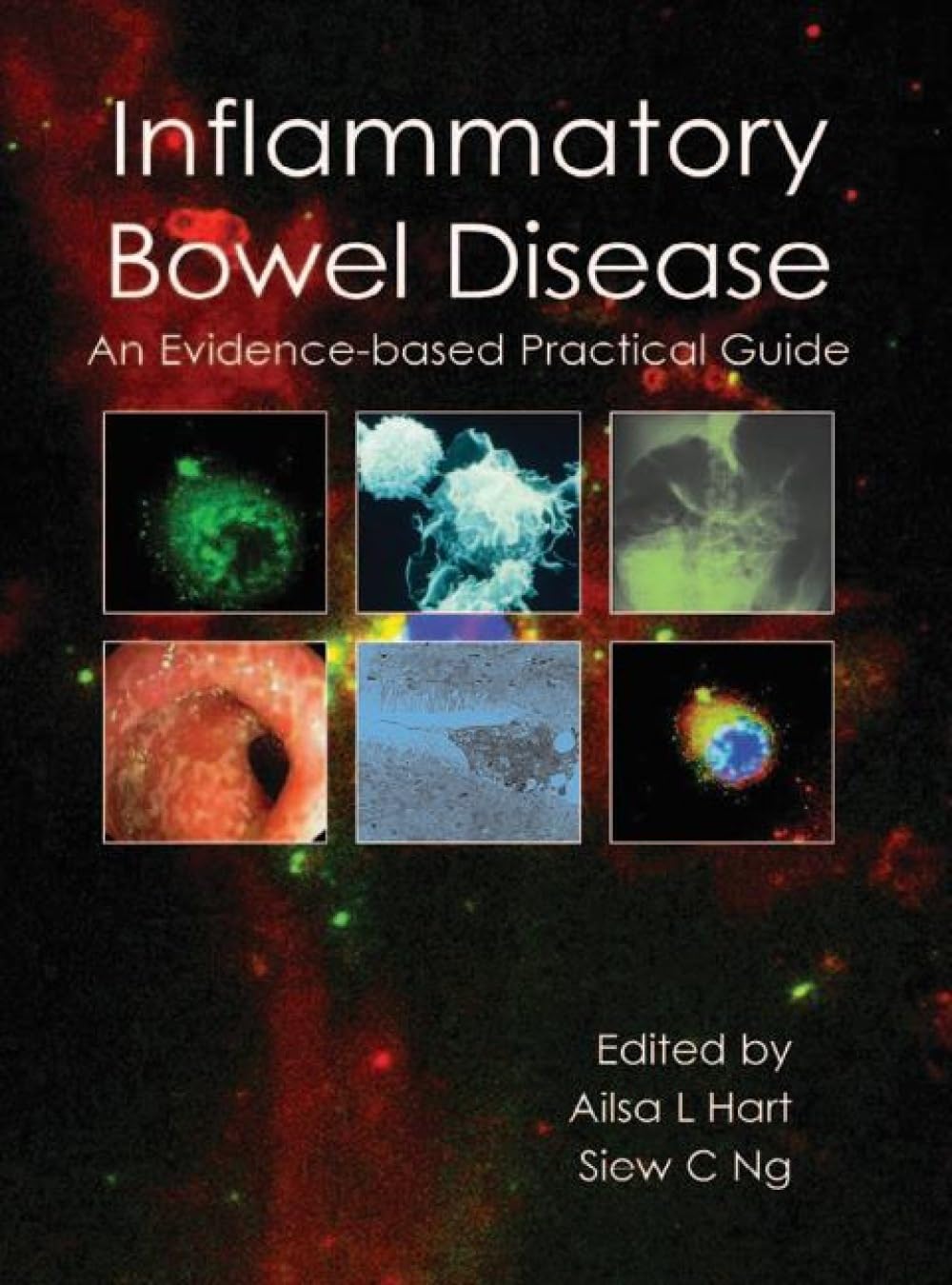 Inflammatory Bowel Disease: An Evidence-Based Practical Guide