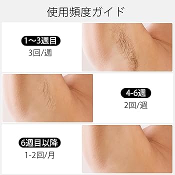 脱毛器 JOVS カレントボディ skin 口コミで話題のJOVSの光脱毛器、英国発カレントボディが夏に向け