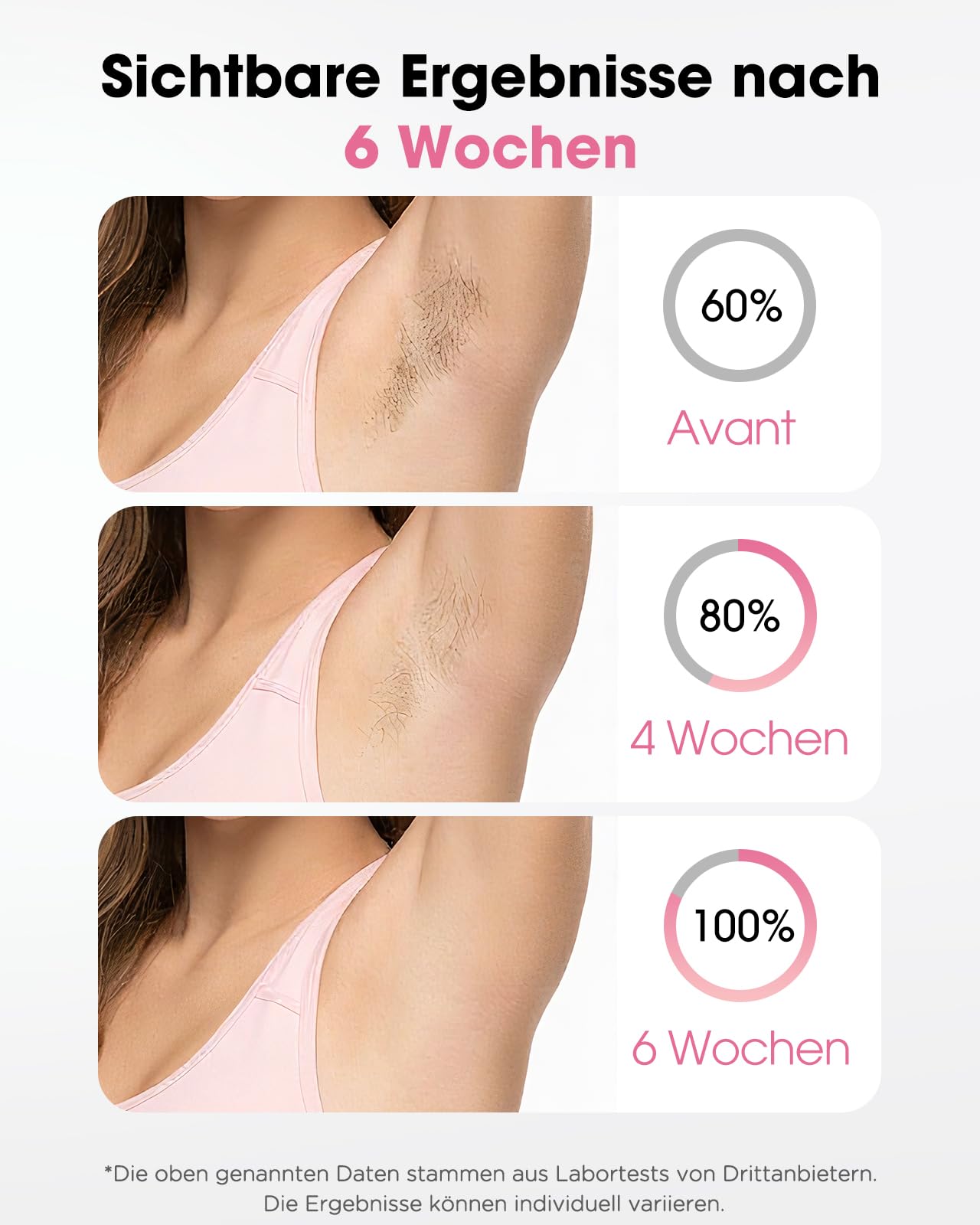 IPL Geräte Haarentfernung Laser - 9 Energiestufen 999900 Lichtimpulse Laser Haarentfernung, Schmerzfreie Haarentfernungsgerät Zuhause für Gesicht Körper Achseln Beine Bikini