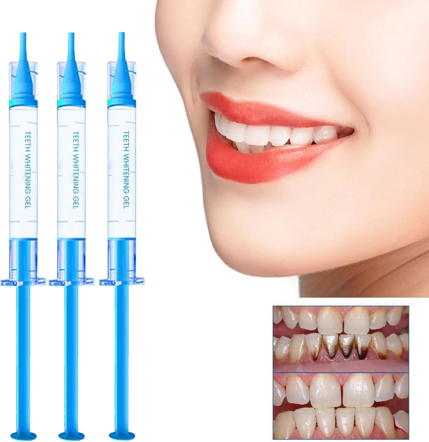 Gocce Rigenerazione Gengivale,Riparazione Ricrescita Delles Gengive,Protezione Cura Dei Denti,Per Tutti,30ML