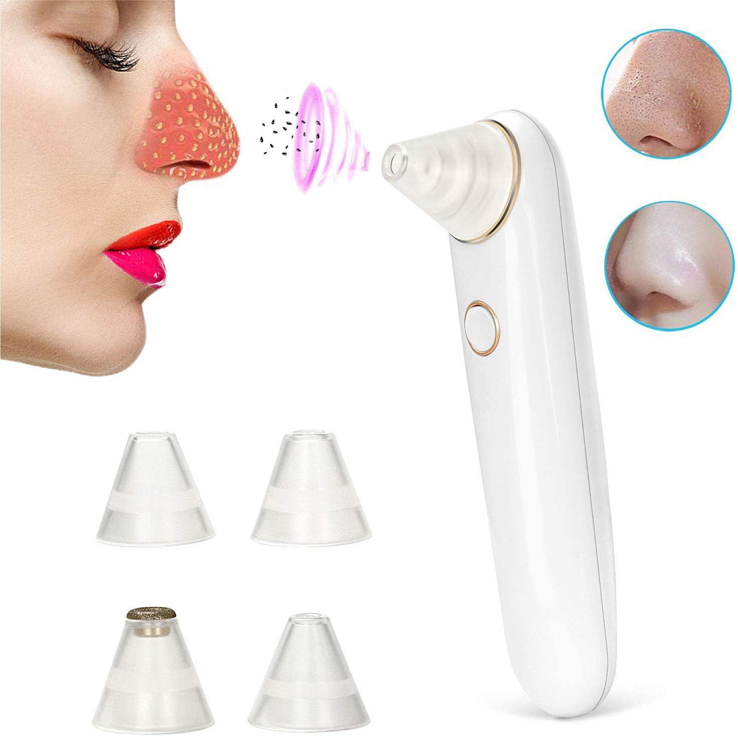 Blackhead Remover, Austruke Blackhead Vacuum Suction Removal, Acne Extractor Tool Set, Skin Facial Pore Cleaner, Comedo Microdermabrasion Exfoliating Machine for Women & Men