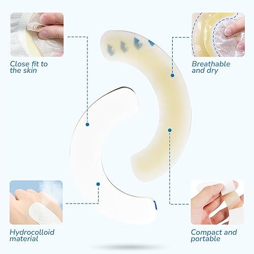 Miniatura 3 de 10 tiras de barrera para ostomía, suministros de ostomía, tira elástica de barrera para la piel, extensores hidrocoloides para bolsas de colostomía