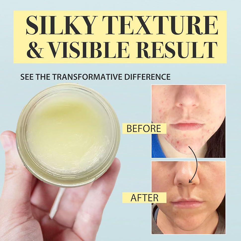 Miniatura 3 de Sarga de ternera para la piel  Sarga alimentada con pasto y bálsamo de miel con aceite de jojoba natural y miel cruda, profundamente nutritiva para