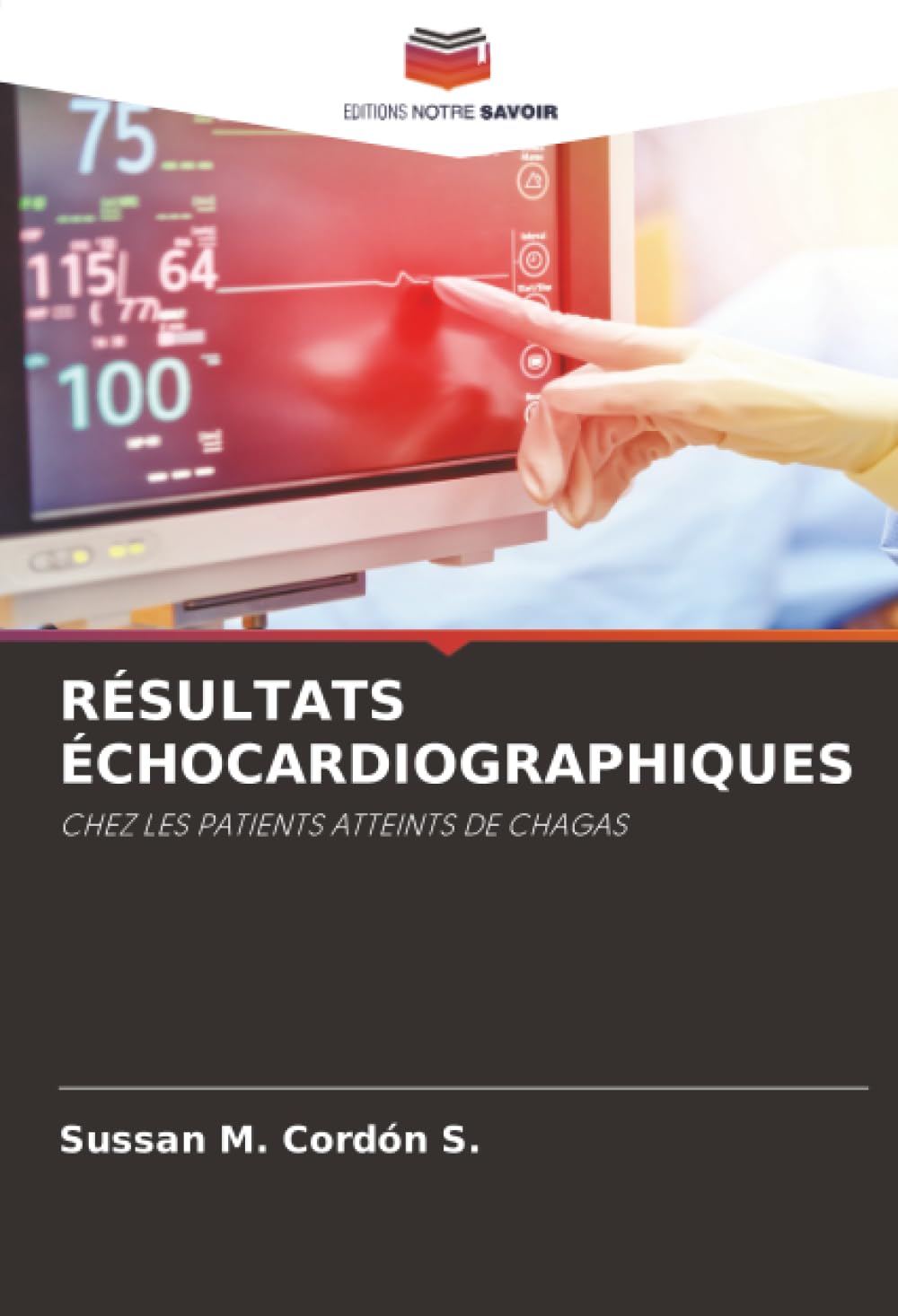 RÉSULTATS ÉCHOCARDIOGRAPHIQUES: CHEZ LES PATIENTS ATTEINTS DE CHAGAS