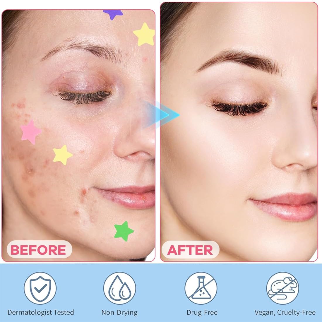 JEYORZY 336 Pezzi pimple patch star, patch brufoli stelline Invisibile Naturale Hydrocolloid, cerotti per brufoli con olio dell'albero tè Acido Salicilico, acne patch Assorbenti Giorno e Notte