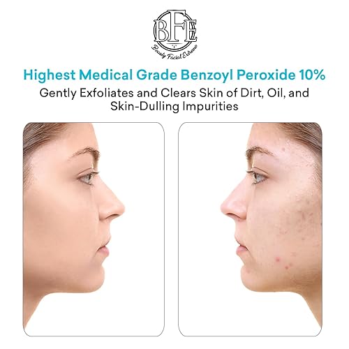 Miniatura 3 de Tratamiento de lavado facial para acné con peróxido de benzoilo al 10% - Combate las imperfecciones del acné al contacto para brotes quísticos, piel