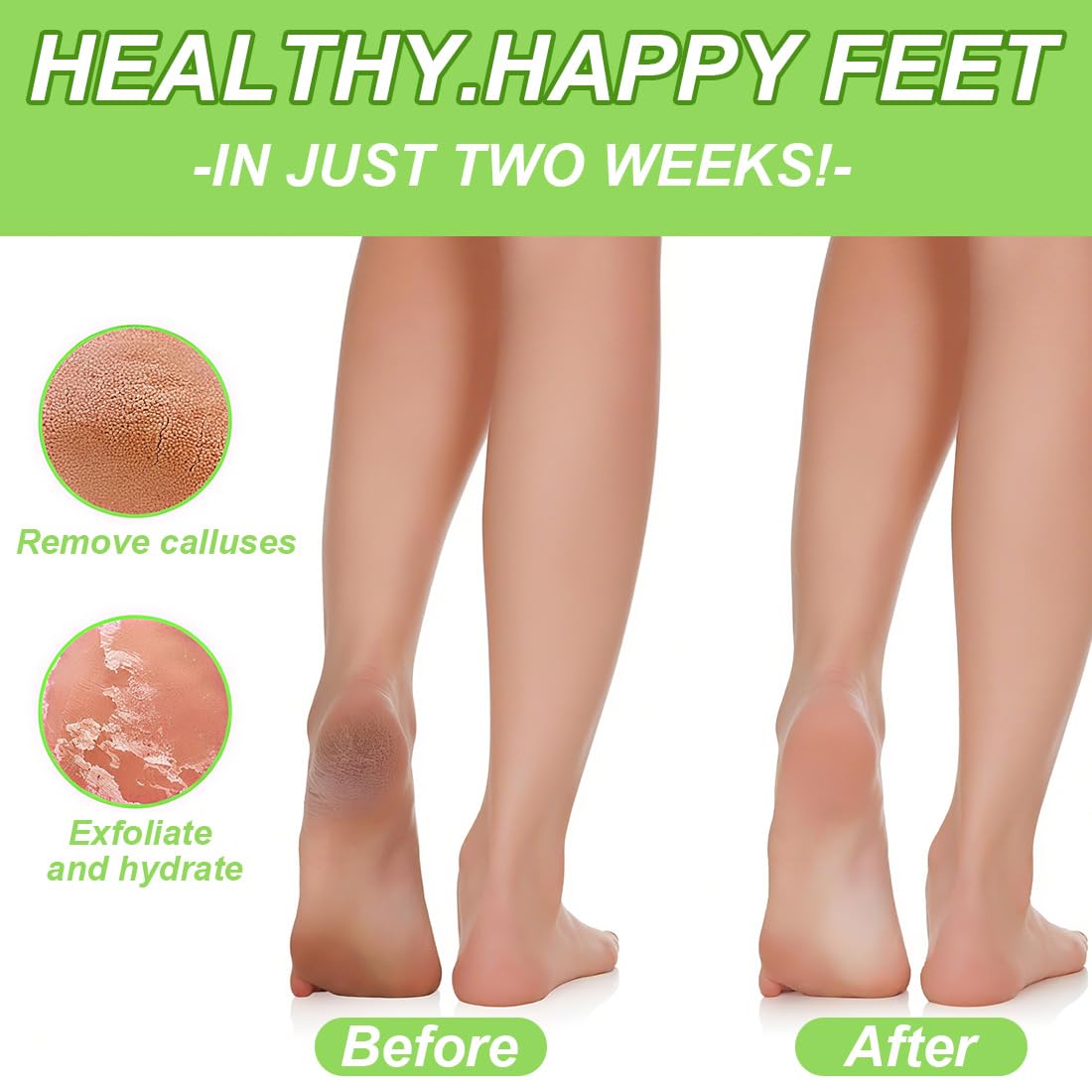 2 Paires Masque Pied, Peeling Pied, Masque Pieds Peeling Exfoliant, Callus Peeling Pieds, Masque Exfoliant Pied Pour Enlever Les Callosités, Aloe Vera