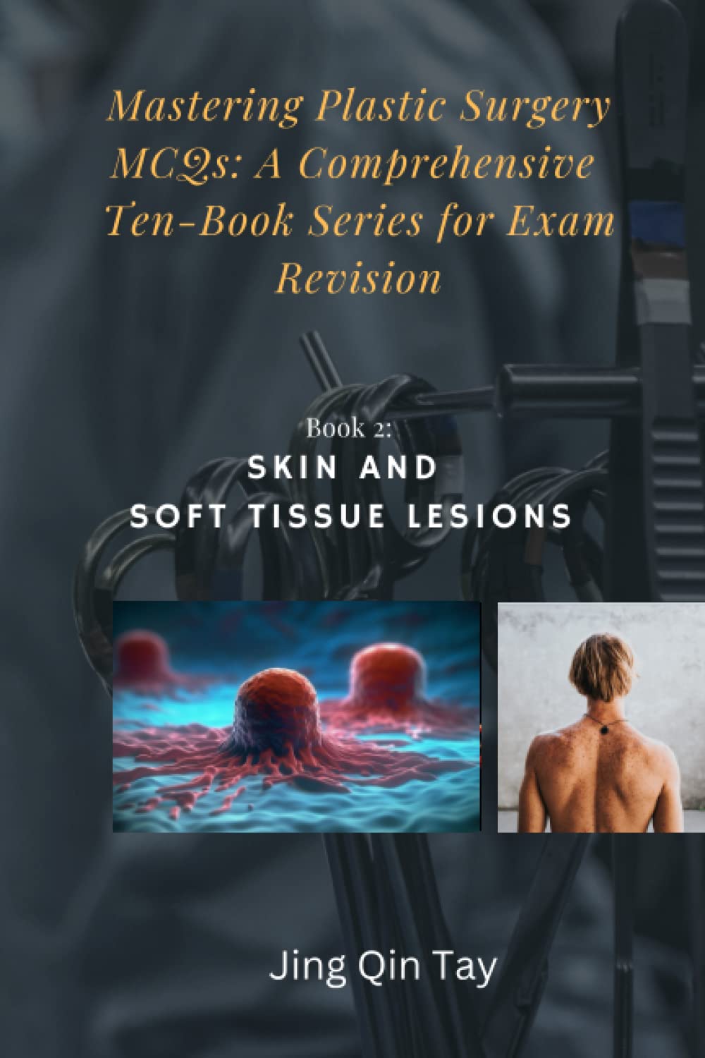 Mastering Plastic Surgery MCQs: A Comprehensive Ten-Book Series for Exam Revision: Book 2: Skin and Soft Tissue Lesions Paperback – 4 April 2023