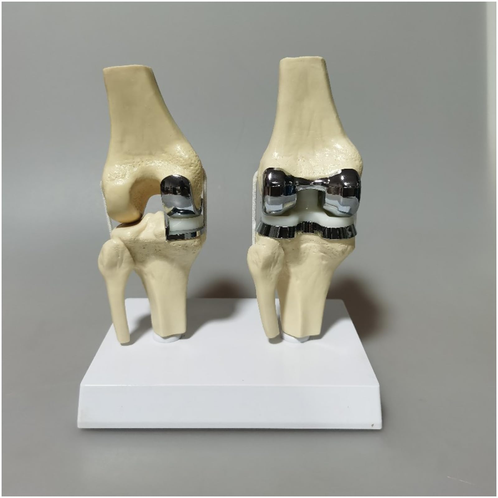 Modello di Protesi articolare del Ginocchio con cartilagine Artificiale Modello di Protesi per Chirurgo Ortopedico clinico Modello di Comunicazione con Il paziente,Bianca,20cm
