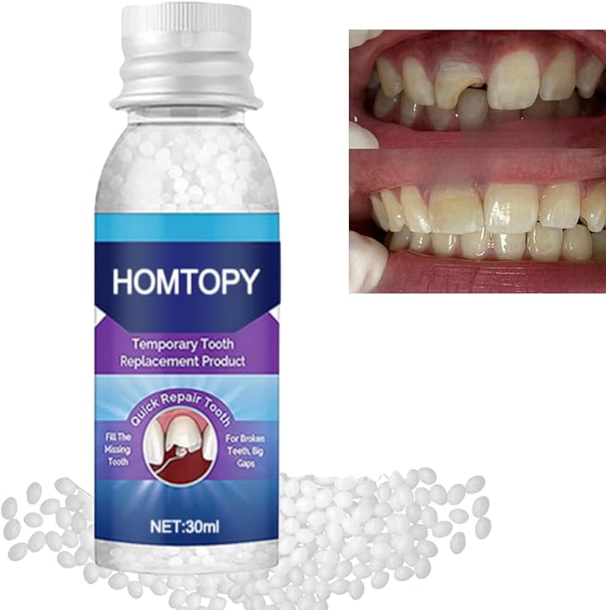 Temporary Tooth Filling Repair Kit,Denture Repair Beads,Moldable False