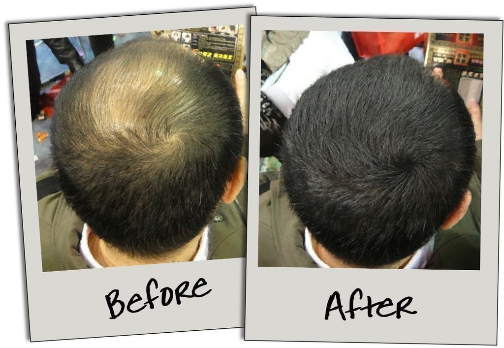 Importikaah Hair Building Fibers Refill Pack (25 Gm) (100 Gm Pack)