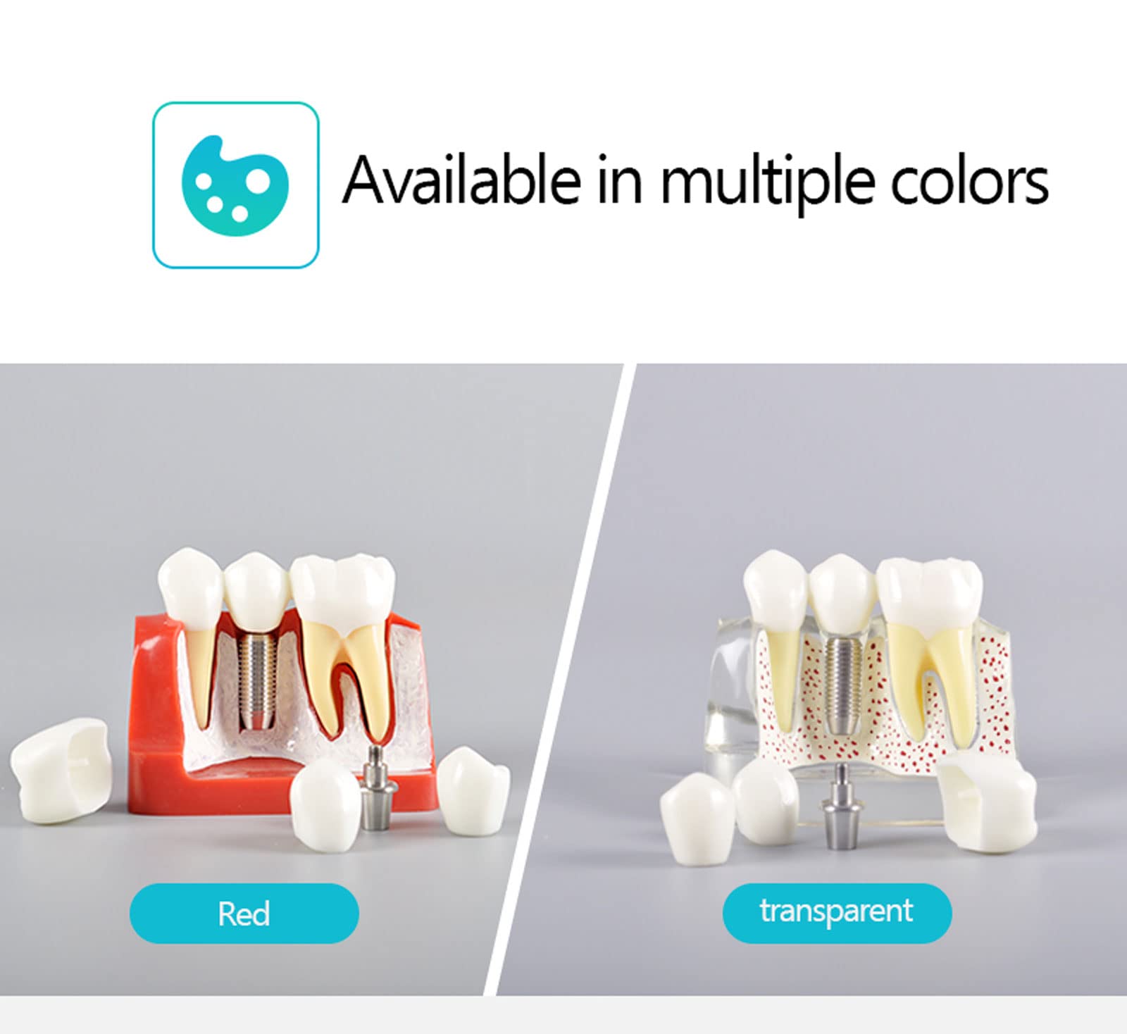 Modello di Denti Analisi, Modello Dentale per Dimostrazione dello Strumento di Insegnamento Dentale in Studio,Denti Analisi Impianto per L'insegnamento e Ricerca Odontoiatrica