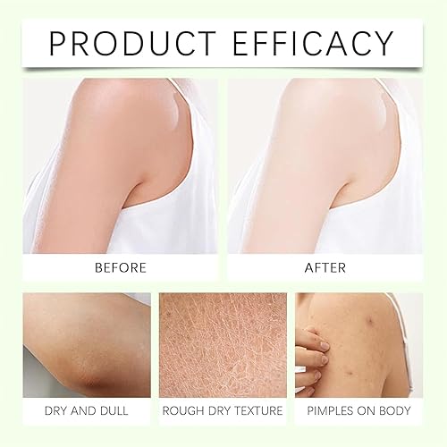 Miniatura 5 de Mama-Bear Neuropathy Cream, Magnesium Body Butter, Magnesium Cream for Neuropathy, Deeply Moisturizes Skin, Keep Soft Smooth, Suitable for All Skin