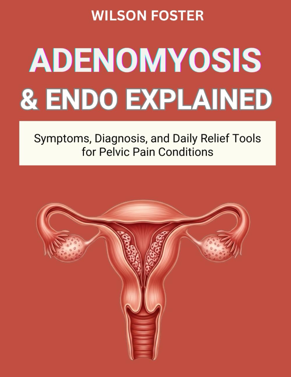 ADENOMYOSIS & ENDO EXPLAINED: Symptoms, Diagnosis, and Daily Relief Tools for Pelvic Pain Conditions