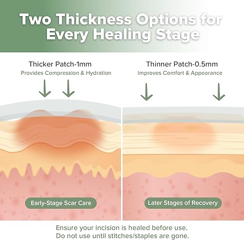 Miniatura 4 de haakaa Tiras de silicona para cicatrices de sección C, hojas de silicona para cicatrices de cesárea y queloides, parches reutilizables de silicona