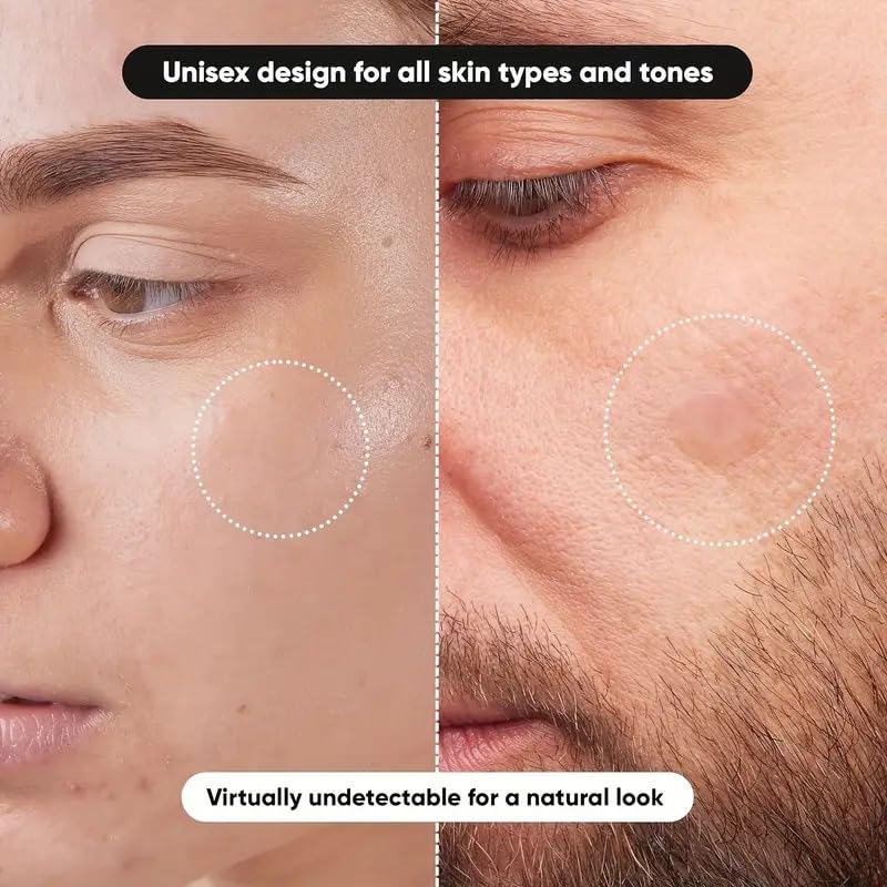 Hydrocolloid Pimple Patch, Acne Patch, Covers Pimples and, Conceals Zits and Blemishes - Image 2